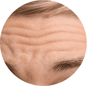 Deep Wrinkles