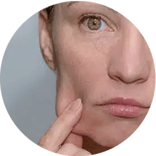 VERLUST AN ELASTIZITÄT